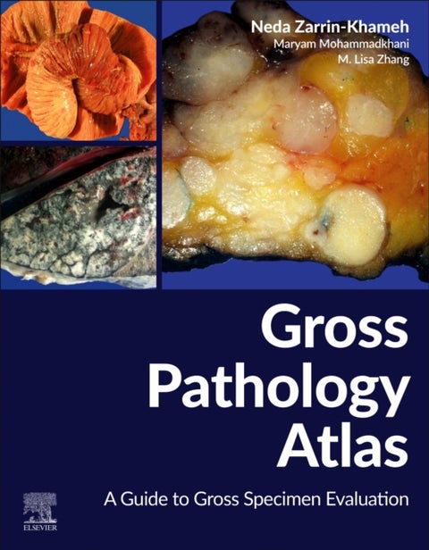 Gross Pathology Atlas - A Guide to Gross Specimens Evaluation