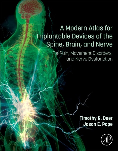 A Modern Atlas for Implantable Devices of the Spine, Brain, and Nerve - For Pain, Movement Disorders, and Nerve Dysfunction