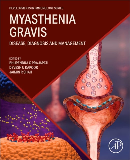 Myasthenia Gravis - Disease, Diagnosis and Management