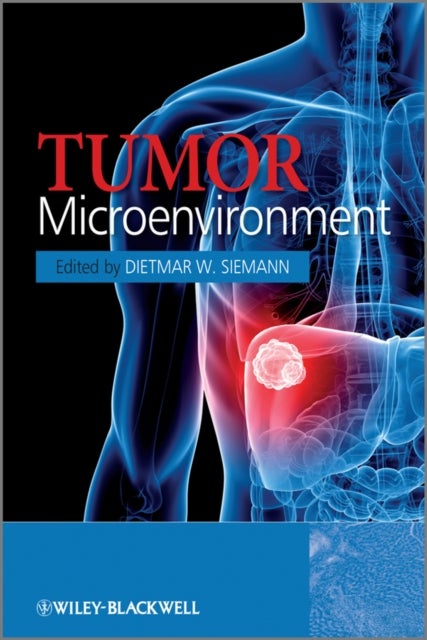 Tumor Microenvironment