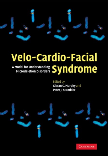 Velo-Cardio-Facial Syndrome - A Model for Understanding Microdeletion Disorders