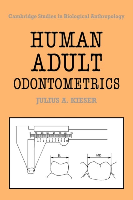 Human Adult Odontometrics - The Study of Variation in Adult Tooth Size