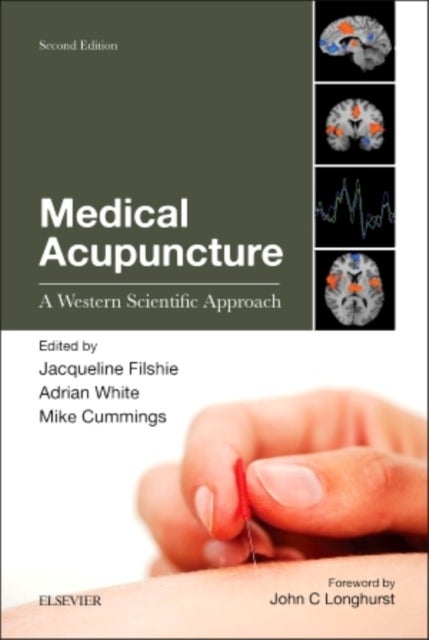 Medical Acupuncture - A Western Scientific Approach
