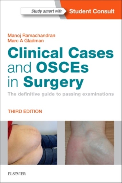 Clinical Cases and OSCEs in Surgery - The definitive guide to passing examinations