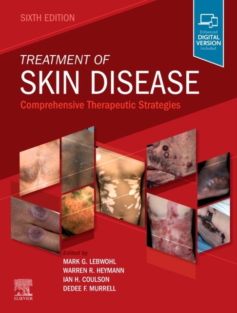 Treatment of Skin Disease - Comprehensive Therapeutic Strategies