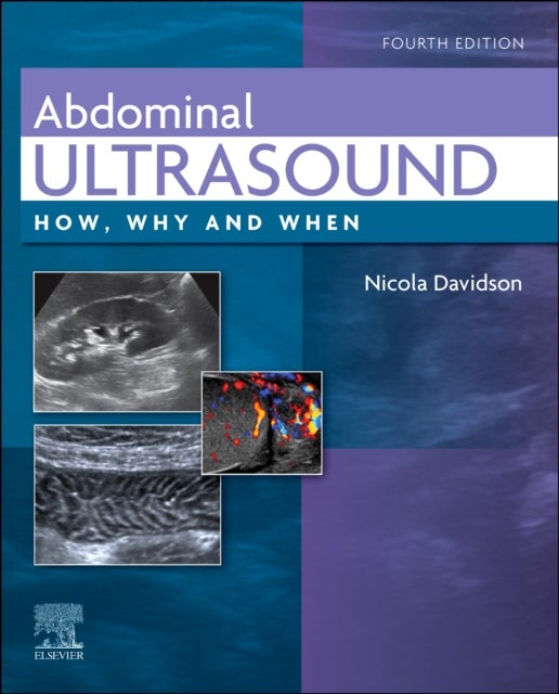 Abdominal Ultrasound