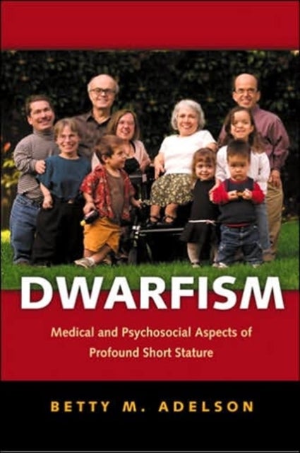 Dwarfism - Medical and Psychosocial Aspects of Profound Short Stature