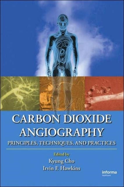 Carbon Dioxide Angiography - Principles, Techniques, and Practices