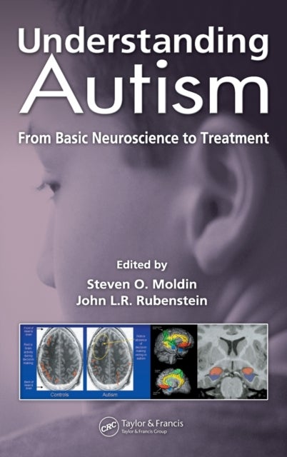 Understanding Autism - From Basic Neuroscience to Treatment