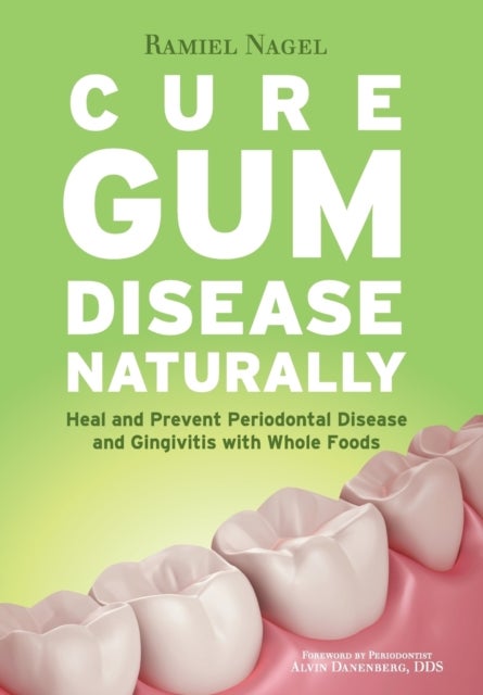Cure Gum Disease Naturally - Heal Gingivitis and Periodontal Disease with Whole Foods