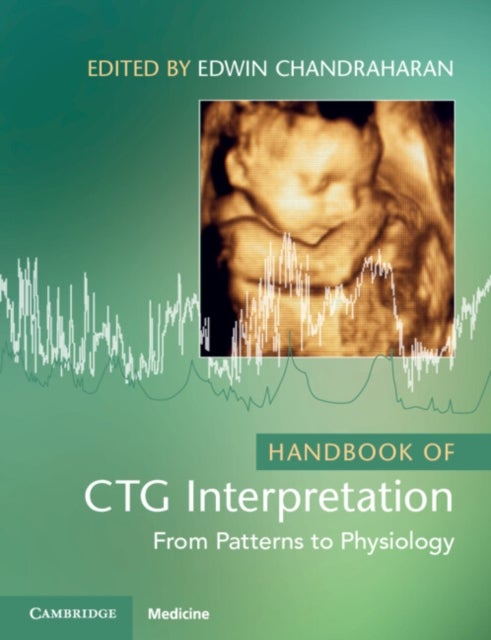 Handbook of CTG Interpretation - From Patterns to Physiology