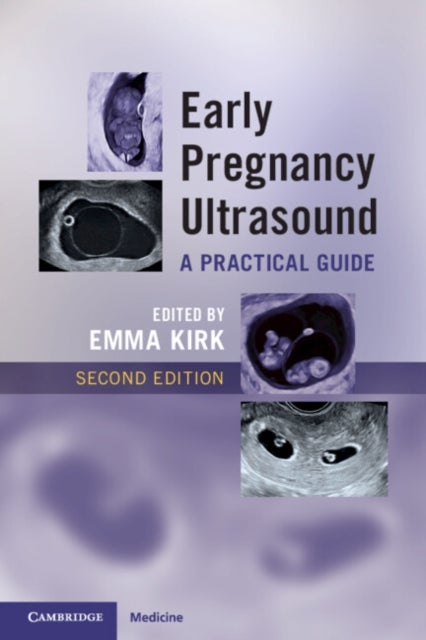 Early Pregnancy Ultrasound - A Practical Guide