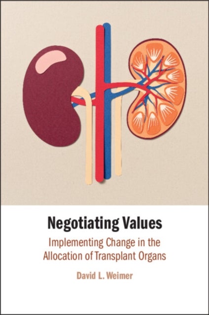 Negotiating Values - Implementing Change in the Allocation of Transplant Organs