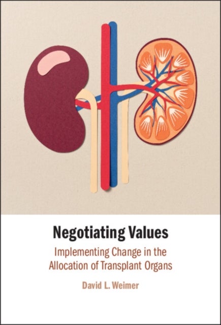 Negotiating Values - Implementing Change in the Allocation of Transplant Organs