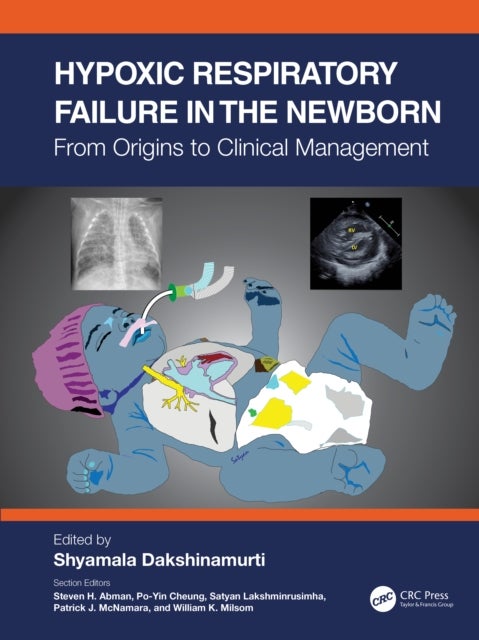 Hypoxic Respiratory Failure in the Newborn - From Origins to Clinical Management