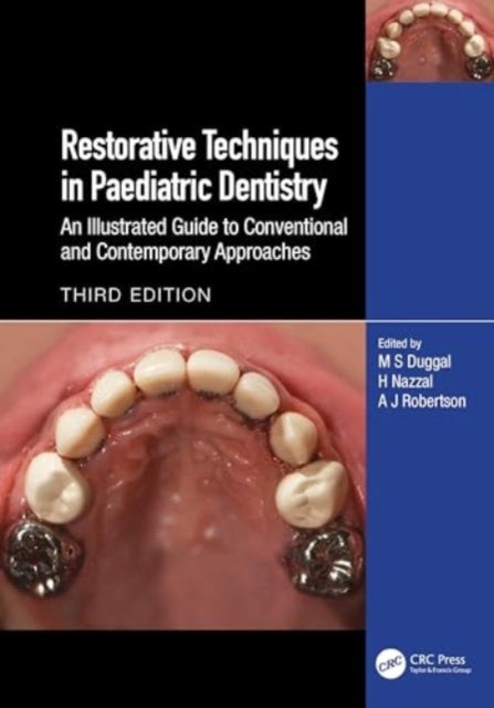 Restorative Techniques in Paediatric Dentistry - An Illustrated Guide to Conventional and Contemporary Approaches