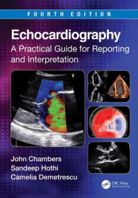 Echocardiography - A Practical Guide for Reporting and Interpretation