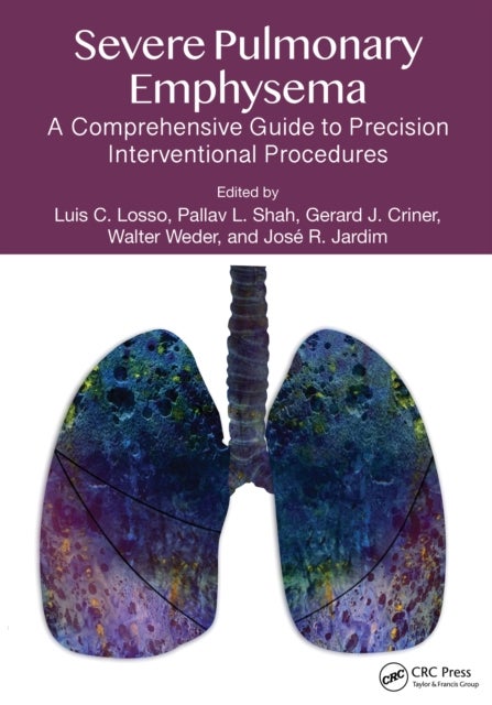Severe Pulmonary Emphysema: - A Comprehensive Guide to Precision Interventional Procedures