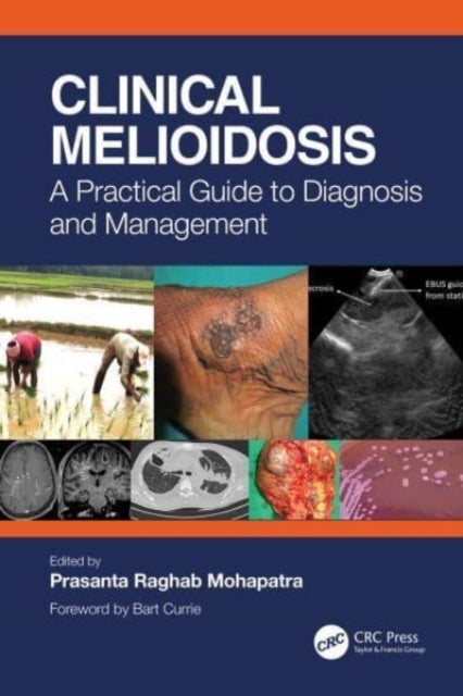 Clinical Melioidosis - A Practical Guide to Diagnosis and Management