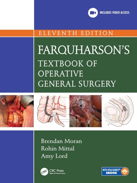 Farquharson's Textbook of Operative General Surgery
