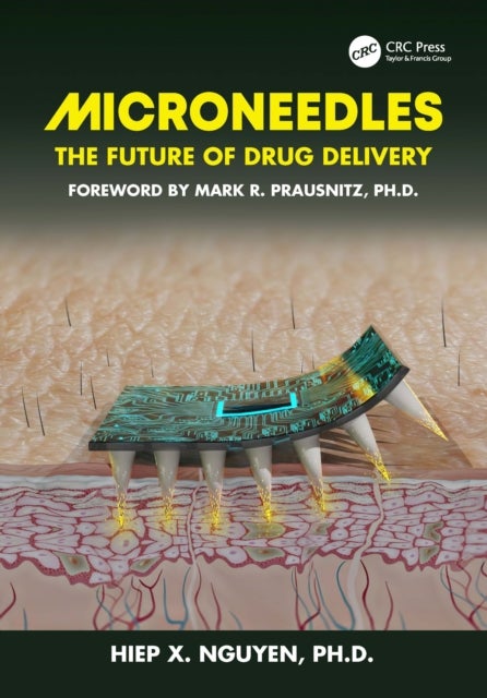 Microneedles - The Future of Drug Delivery
