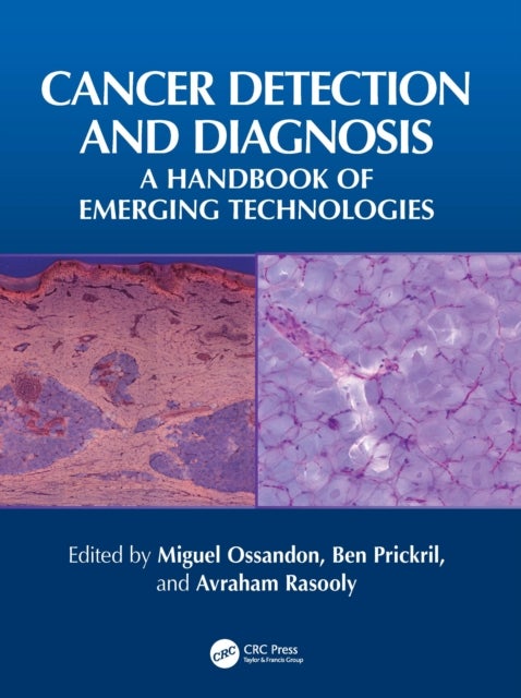 Cancer Detection and Diagnosis - A Handbook of Emerging Technologies