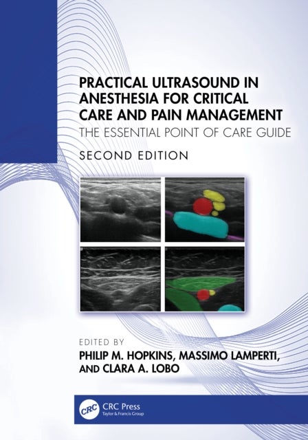 Practical Ultrasound in Anesthesia for Critical Care and Pain Management - The Essential Point of Care Guide