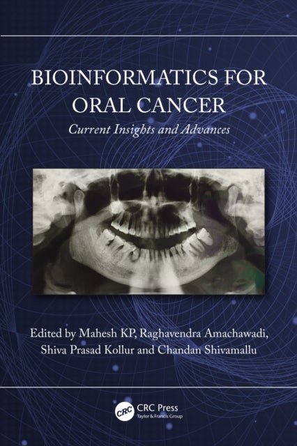 Bioinformatics for Oral Cancer - Current Insights and Advances