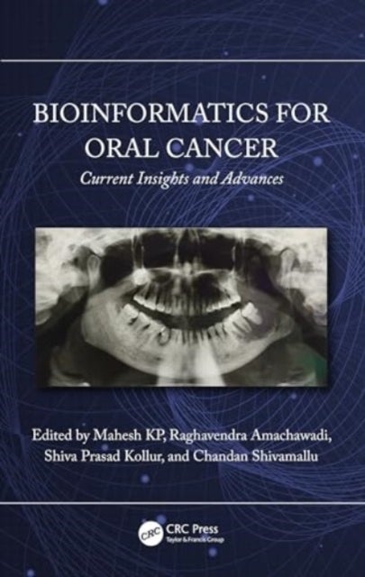 Bioinformatics for Oral Cancer - Current Insights and Advances