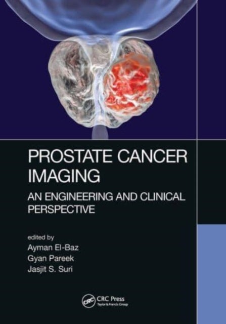 Prostate Cancer Imaging - An Engineering and Clinical Perspective