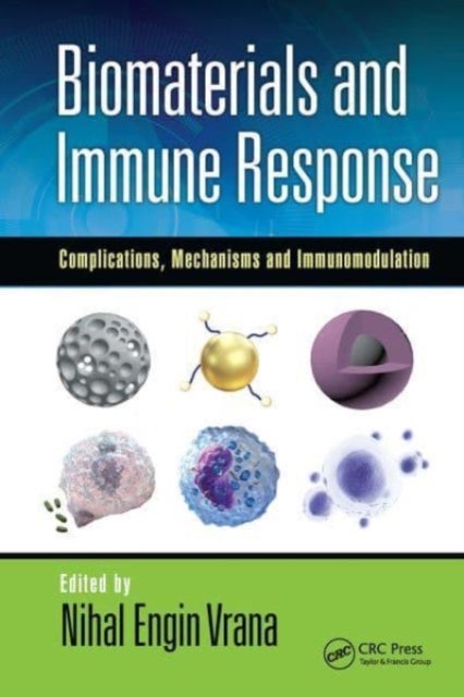 Biomaterials and Immune Response - Complications, Mechanisms and Immunomodulation