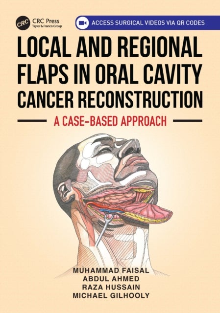 Local and Regional Flaps in Oral Cavity Cancer Reconstruction - A case-based approach