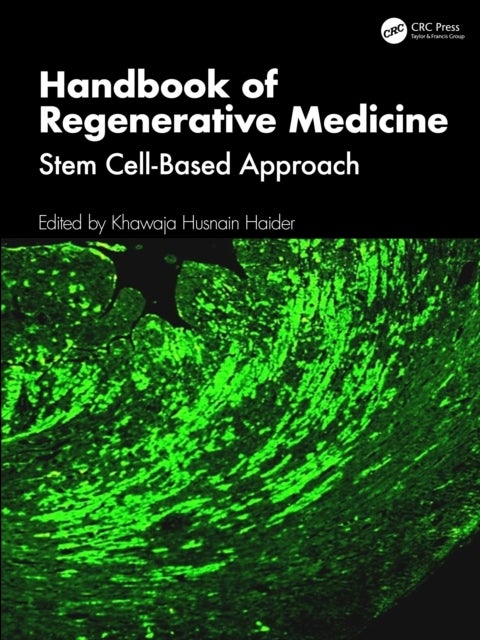 Handbook of Regenerative Medicine - Stem Cell-based Approach