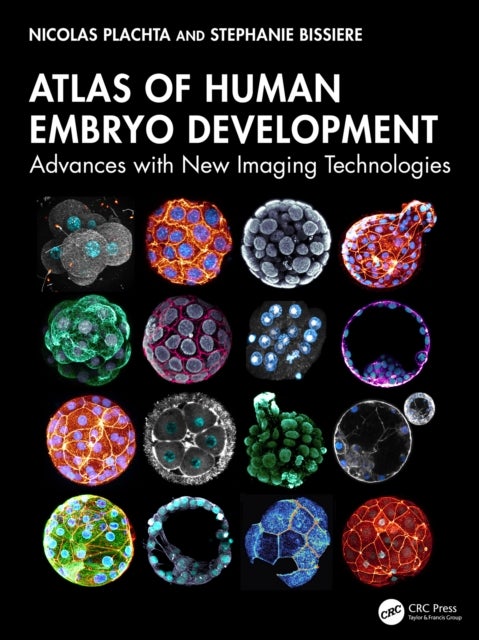 Atlas of Human Embryo Development - Advances with New Imaging Technologies