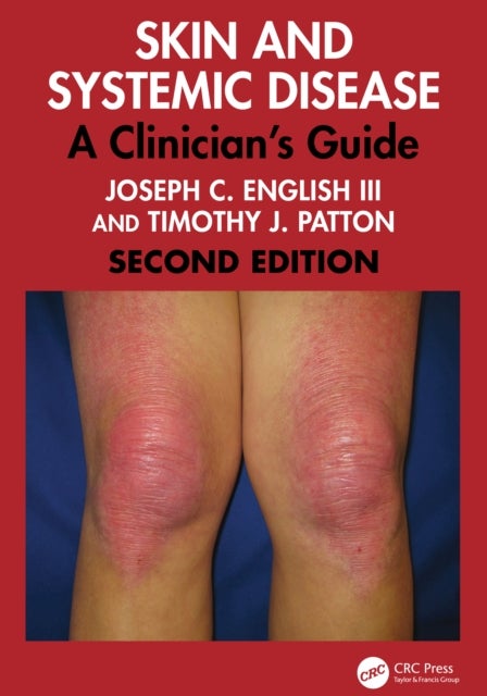 Skin and Systemic Disease - A Clinician's Guide