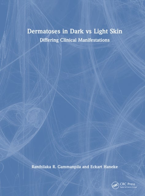 Dermatoses in Dark Vs Light Skin - Differing Clinical Manifestations