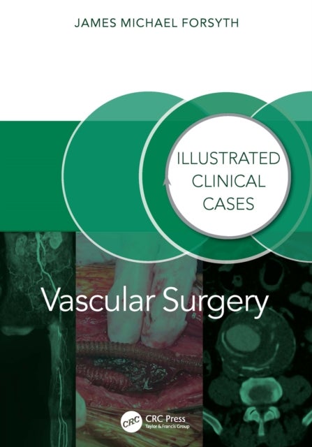 Vascular Surgery: - Illustrated Clinical Cases