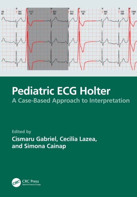 Pediatric ECG Holter - A Case-Based Approach to Interpretation