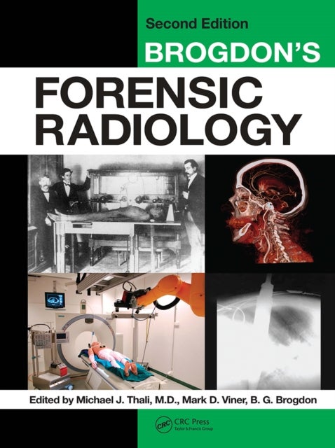 Brogdon's Forensic Radiology