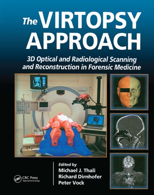The Virtopsy Approach - 3D Optical and Radiological Scanning and Reconstruction in Forensic Medicine