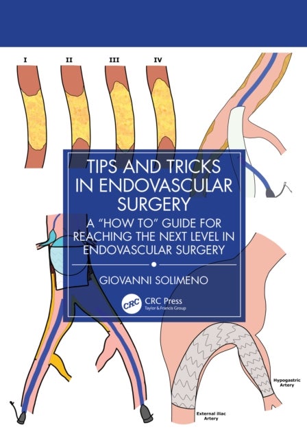 Tips and Tricks in Endovascular Surgery - A "How to" Guide for reaching the next Level in Endovascular Surgery