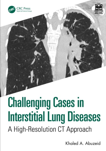 Challenging Cases in Interstitial Lung Diseases - A High-Resolution CT Approach