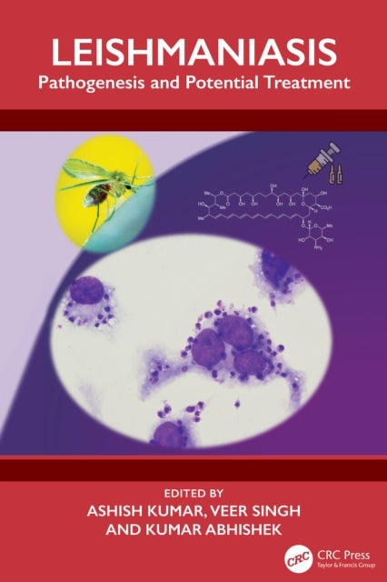 Leishmaniasis - Pathogenesis and Potential Treatment