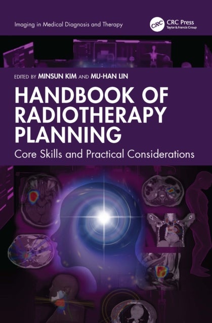 Handbook of Radiotherapy Planning - Core Skills and Practical Considerations
