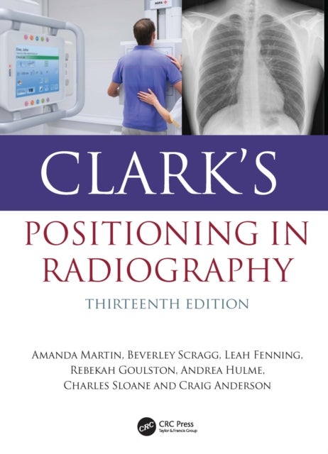 Clark's Positioning in Radiography