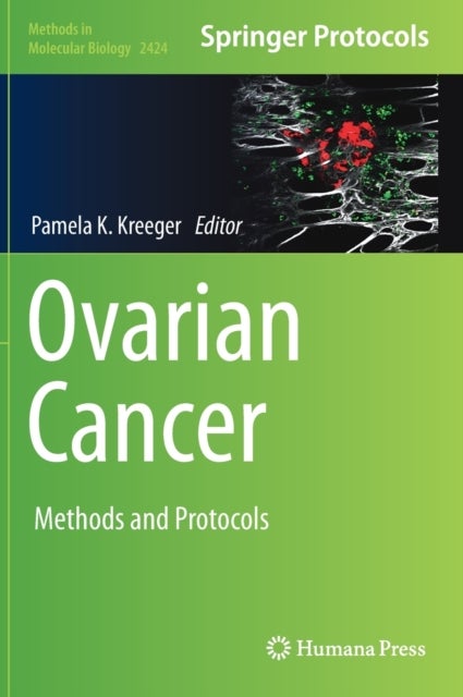 Ovarian Cancer - Methods and Protocols