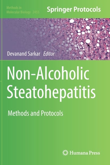 Non-Alcoholic Steatohepatitis - Methods and Protocols