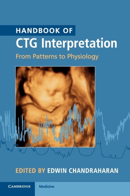 Handbook of CTG Interpretation - From Patterns to Physiology
