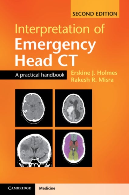 Interpretation of Emergency Head CT - A Practical Handbook