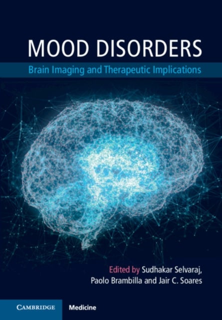 Mood Disorders - Brain Imaging and Therapeutic Implications